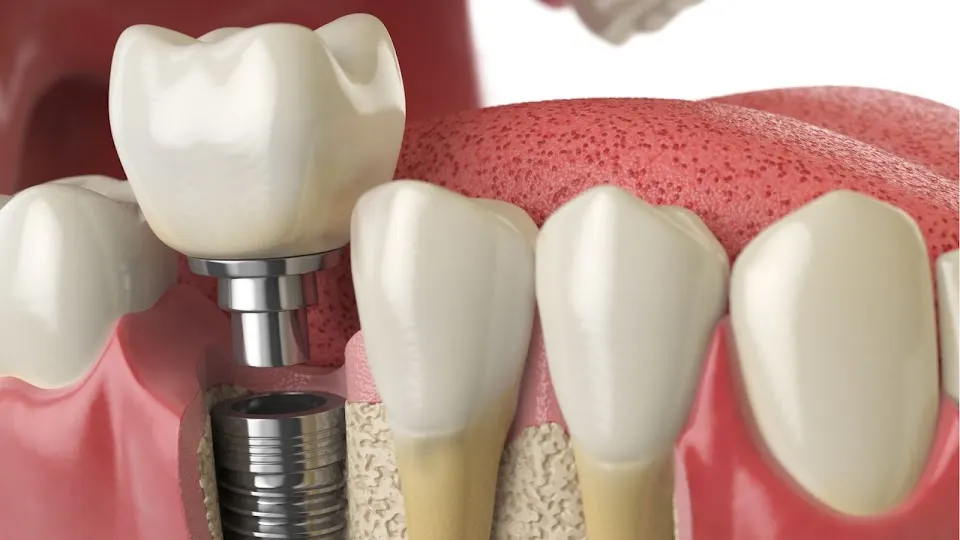 Baltimore City Dental Group - Dentist in Baltimore, MD