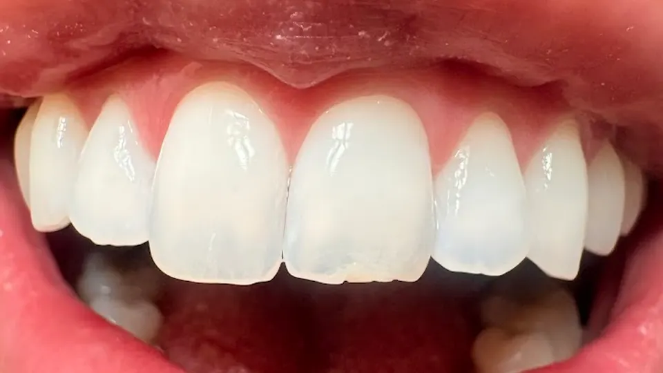 Celebrate Dental & Braces - Independence - Dentist in Kansas City, MO