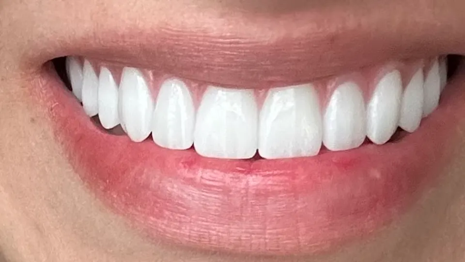 ClearChoice Dental Implant Center - Nashville - Dental implants provider in Nashville, Tennessee