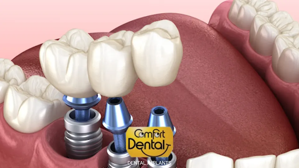Comfort Dental - Dentist in Providence, RI
