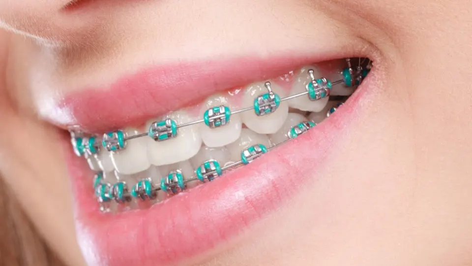 Happy Smiles Dental Group - Dentist in Las Vegas, NV