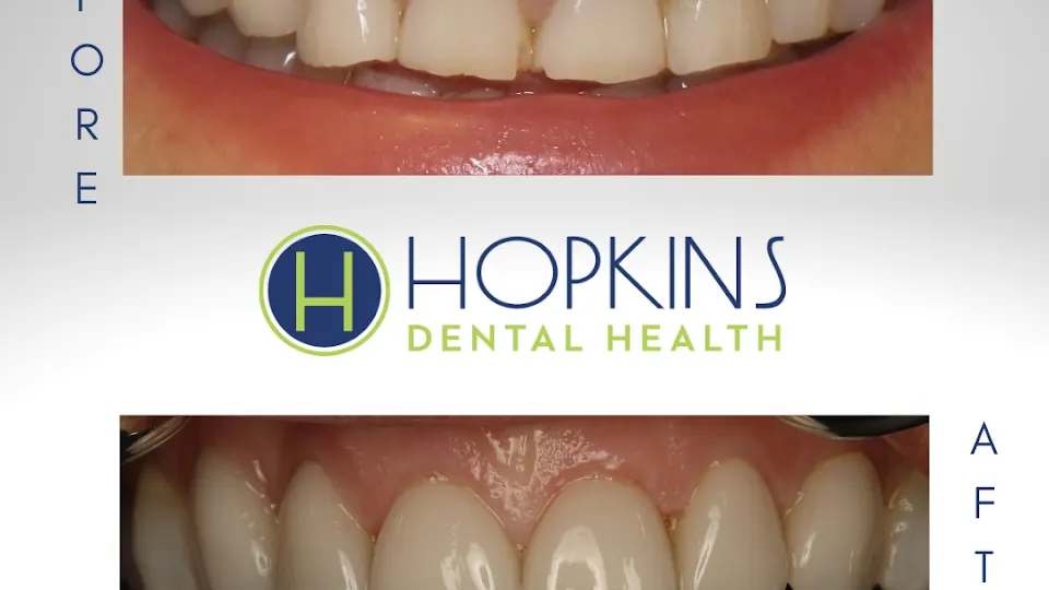 Hopkins Dental Health: Cosmetic Dentistry - Dentist in Kansas City, MO
