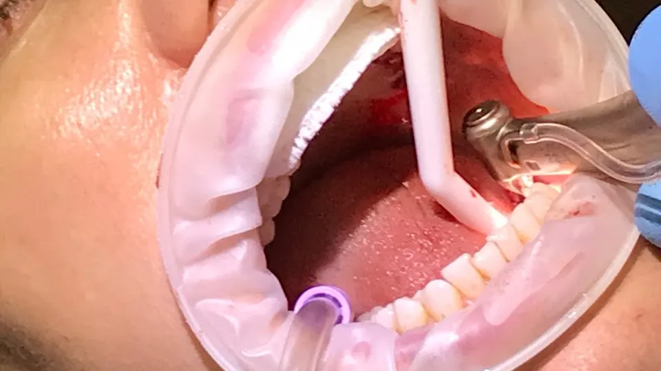 John G Masso DDS- Belcourt Family Dentistry PC - Cosmetic dentist in Nashville, TN