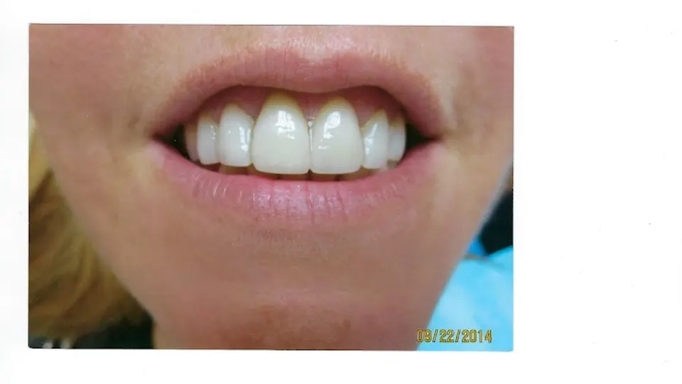 Lesley R. Rosenthal, DDS, PC - Cosmetic dentist in New York, New York