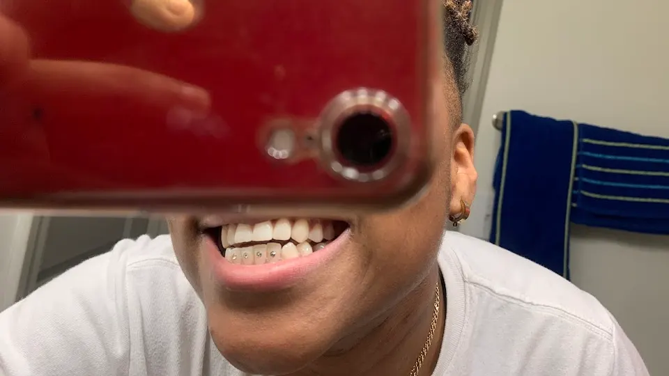 Luxe Dental Company - Teeth whitening service in Atlanta, GA