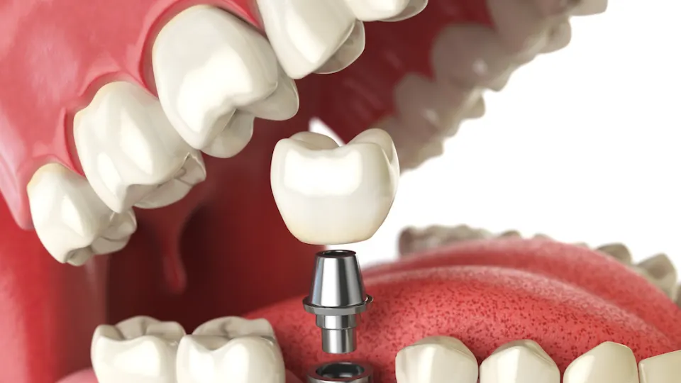 Mass Dental Associates - Dentist in Boston, MA