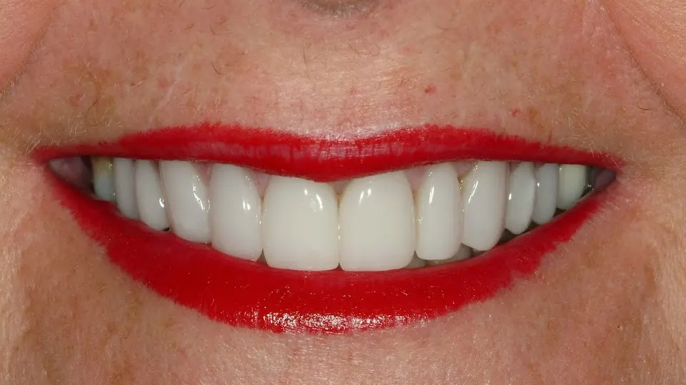 Meadowlark Dental Associates - Kearney, NE - Dentist in Kearney, NE