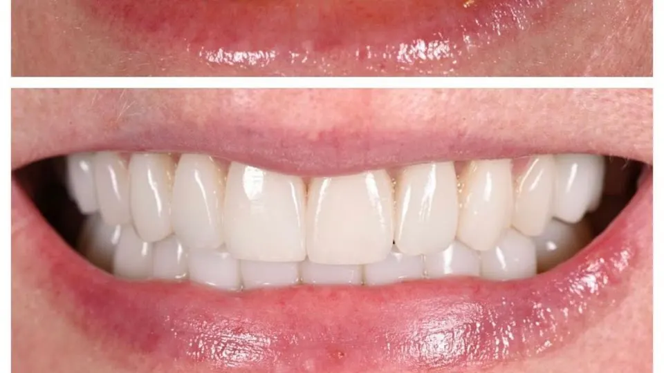 Minot Dental Partners - Dentist in Minot, ND