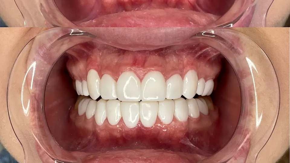 Mussi King Dental - Cosmetic dentist in Miami, FL