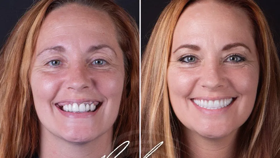 My New Smile Dental - Dentist in Nashville, Tennessee