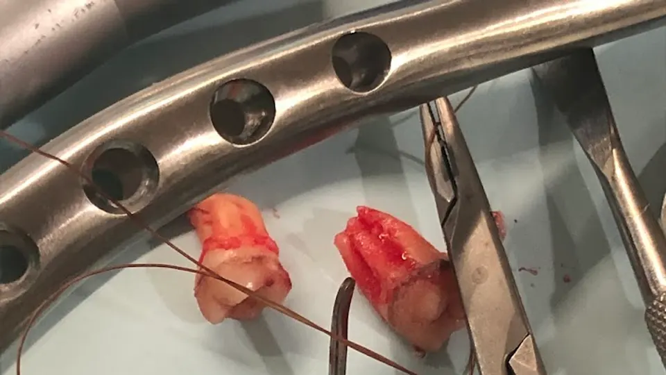 Now Dentistry - Dental clinic in Baltimore, MD