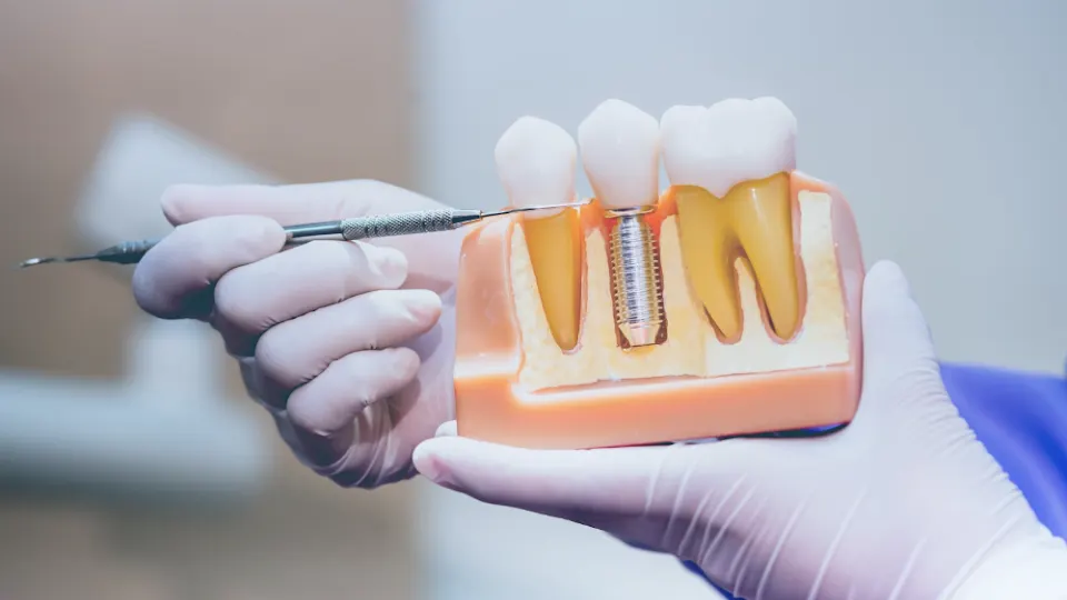 Parkway Family Dental - Dentist in Louisville, KY