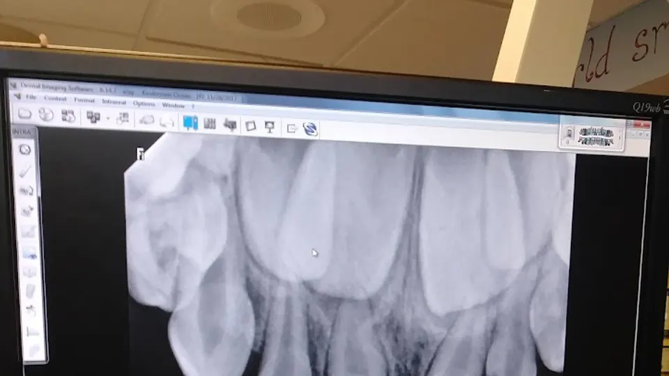 Pediatric Dentistry - Dentist in Eau Claire, WI