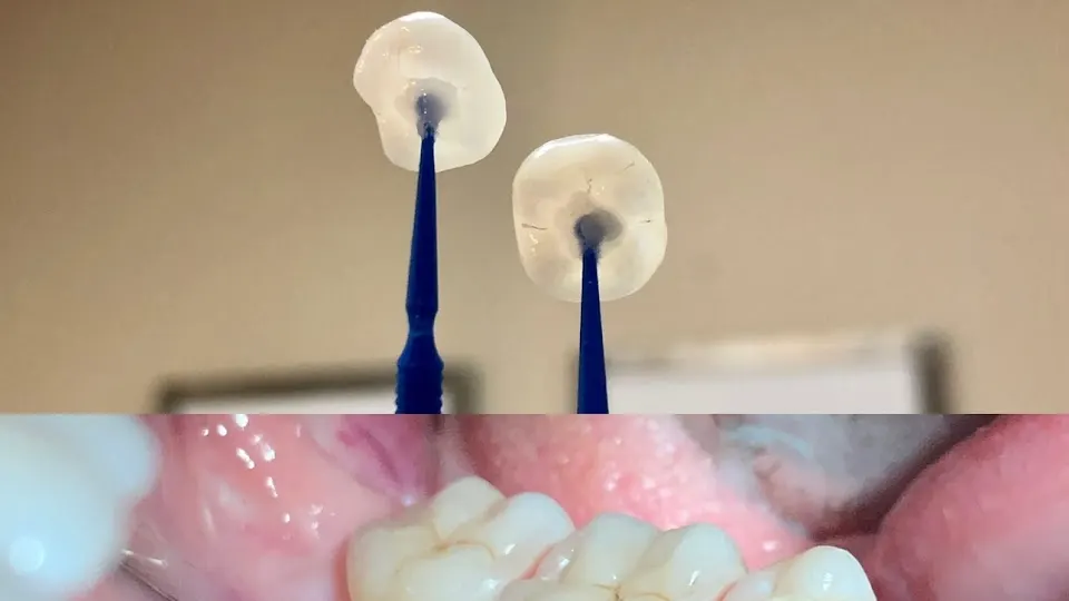 Preserve Your Teeth Dentistry - Alice Urbankova, DDS, PHD - Rockefeller Center, Manhattan - Dentist in New York, NY