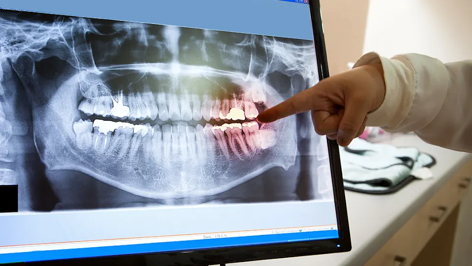 Remington Family Dental - Dentist in Billings, MT