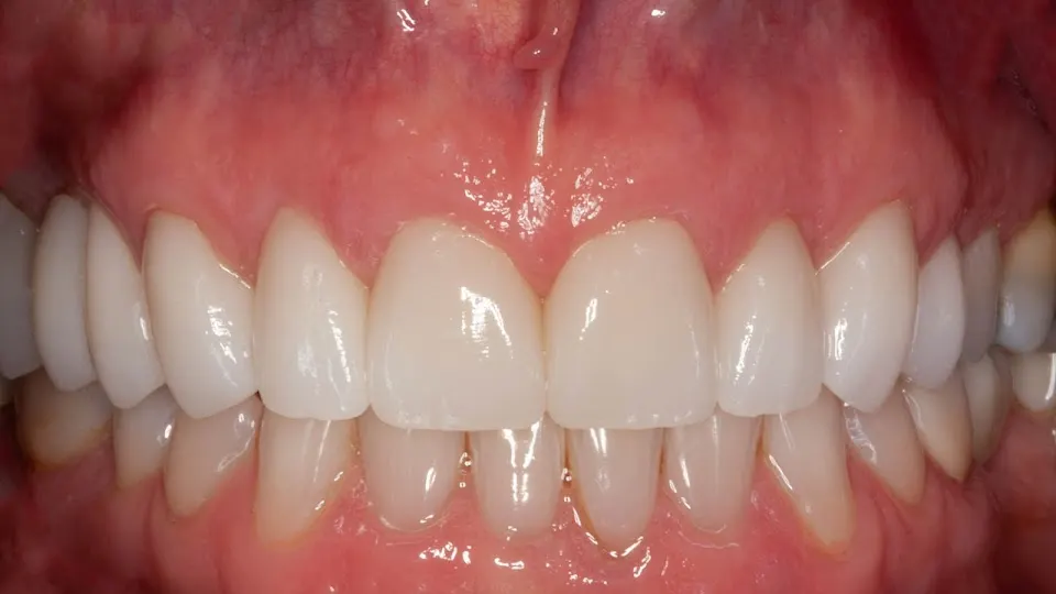 Scott Breazeale, DMD - Cosmetic dentist in Biloxi, MS