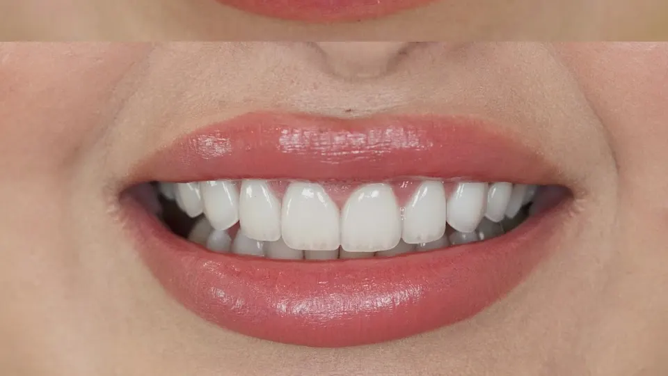 Seviin Cosmetics - Dentist in Houston, Texas