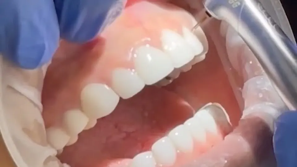 Smile Dental Center Miami | Porcelain Veneers Miami - Cosmetic dentist in Miami, FL