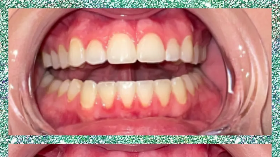 Smile Labs of Houma LLC - Teeth whitening service in Houma, LA