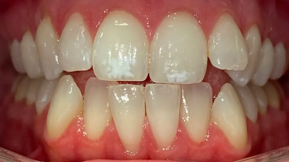 Team Dental - Northern Liberties - Dentist in Philadelphia, Pennsylvania