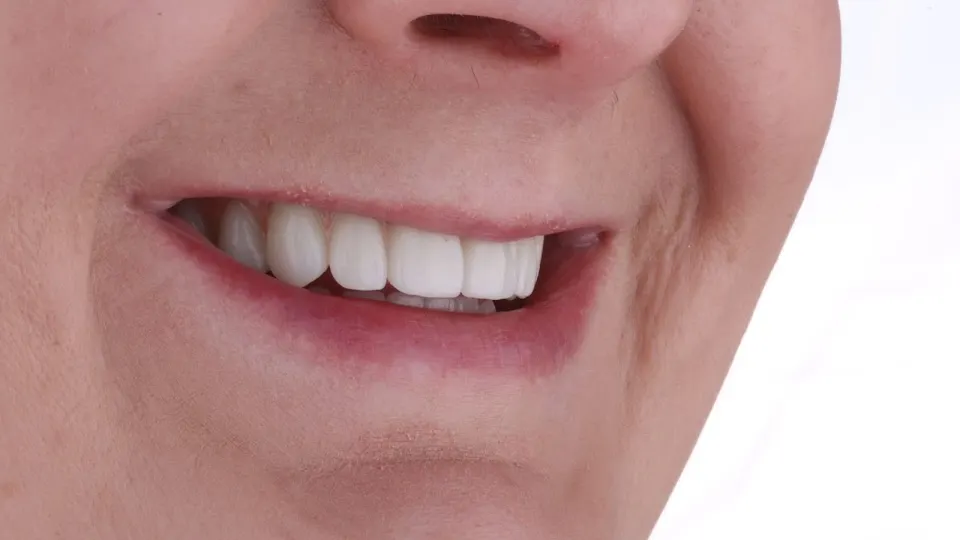 The Dental Center of Manchester - Dental implants provider in Manchester, New Hampshire
