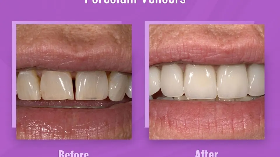 Thomas Smile Designs - Dentist in Billings, Montana